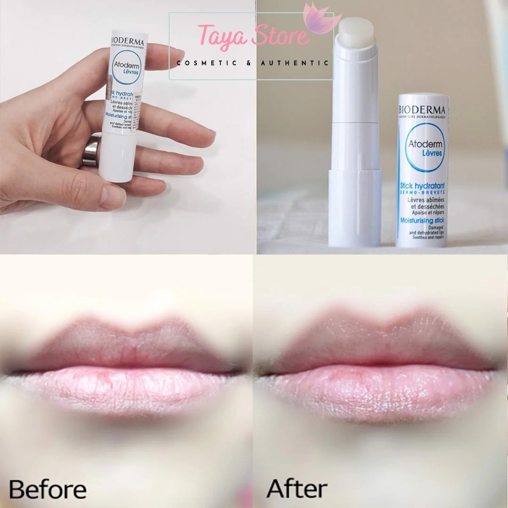 Son dưỡng môi Bioderma Atoderm Lèvres Stick Hydratant Moisturising Pháp