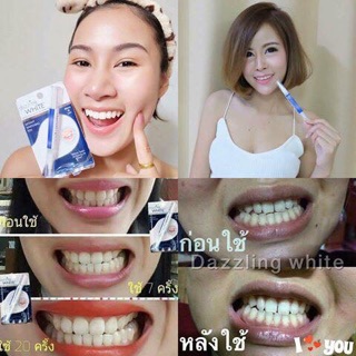 [Giasi261] BÚT TẨY TRẮNG RĂNG DAZZLING WHITE