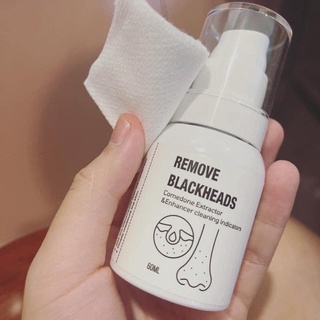 Ủ mụn đầu đen remove blackheads