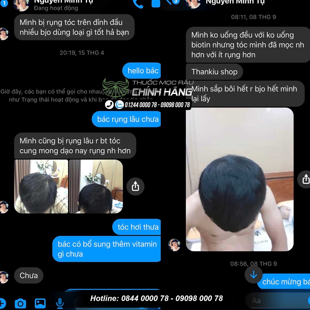 Biotin 10000 Mcg 100 Viên Của Mỹ