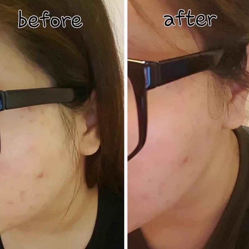 Tinh dầu Tea Tree Oil The Body Shop | BigBuy360 - bigbuy360.vn