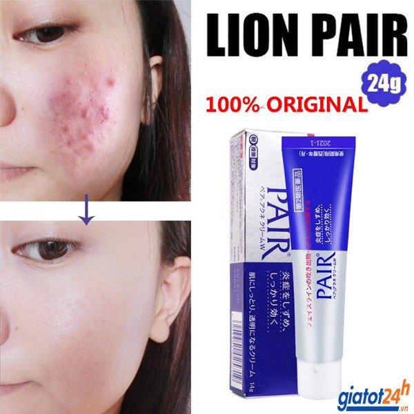 [Nhật nội địa] Kem Hỗ Trợ Cải Thiện Mụn Lion Pair Nhật Bản 24g