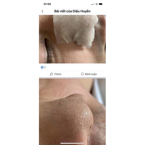 Dung dịch ủ mụn Medipeel