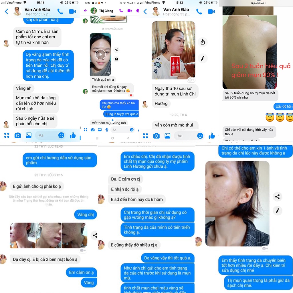 Bộ Serum mụn Linh Hương Purity Skin 11ml đánh bay mụn hết thâm làm mịn da hiệu quả trong 11 ngày