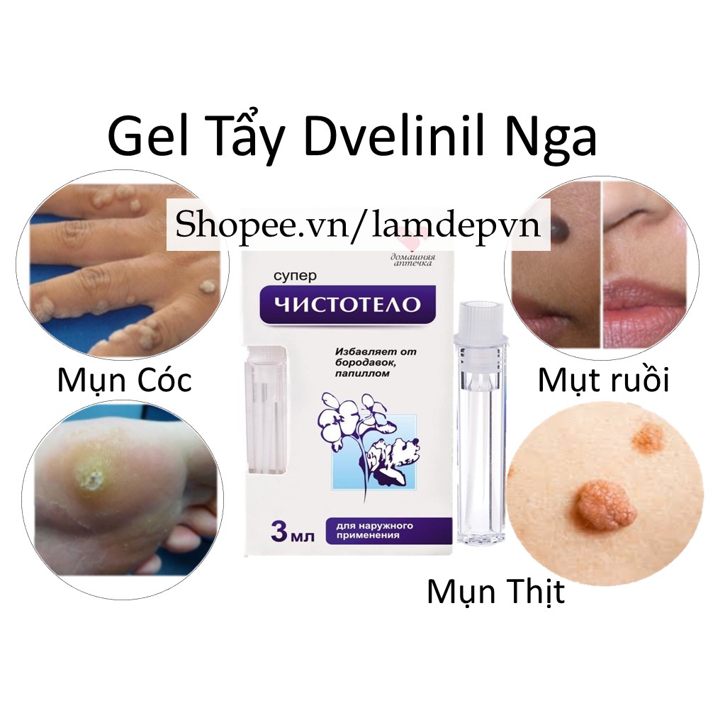 Gel tẩy nốt ruồi mụn cóc mụn thịt mụn cơm mụn ruồi Nga