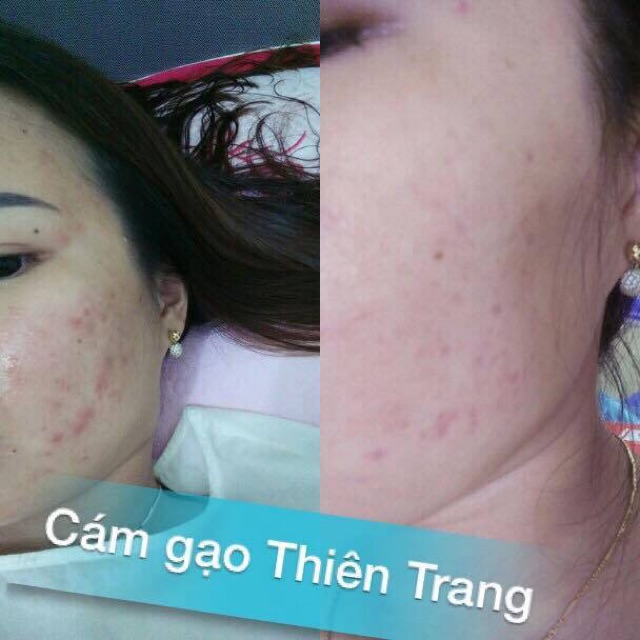 Cám gạo Ngọc trai thảo dược 50g | BigBuy360 - bigbuy360.vn