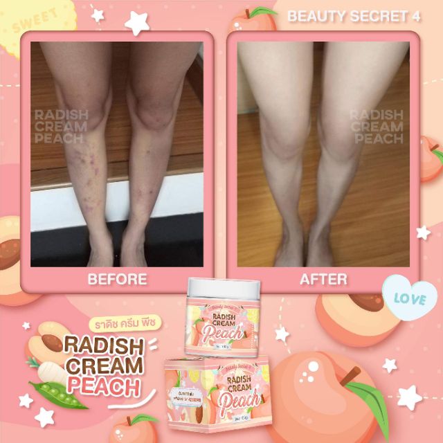 Kem Ngăn Ngừa Thâm, Rạn Da, Mờ Sẹo, Dưỡng Trắng Toàn Thân RADISH CREAM PEACH Beauty Secret 4 100g - Thái Lan | BigBuy360 - bigbuy360.vn