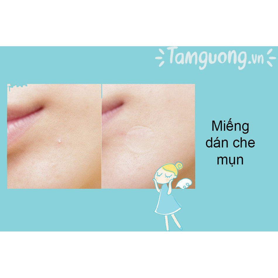 Miếng dán mụn Beaumore’s Blemish mụn sưng viêm, mụn bọc, mụn đỏ, đầu trắng...(Mỹ)