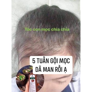 Kem ủ tóc tinh chất thiên nhiên