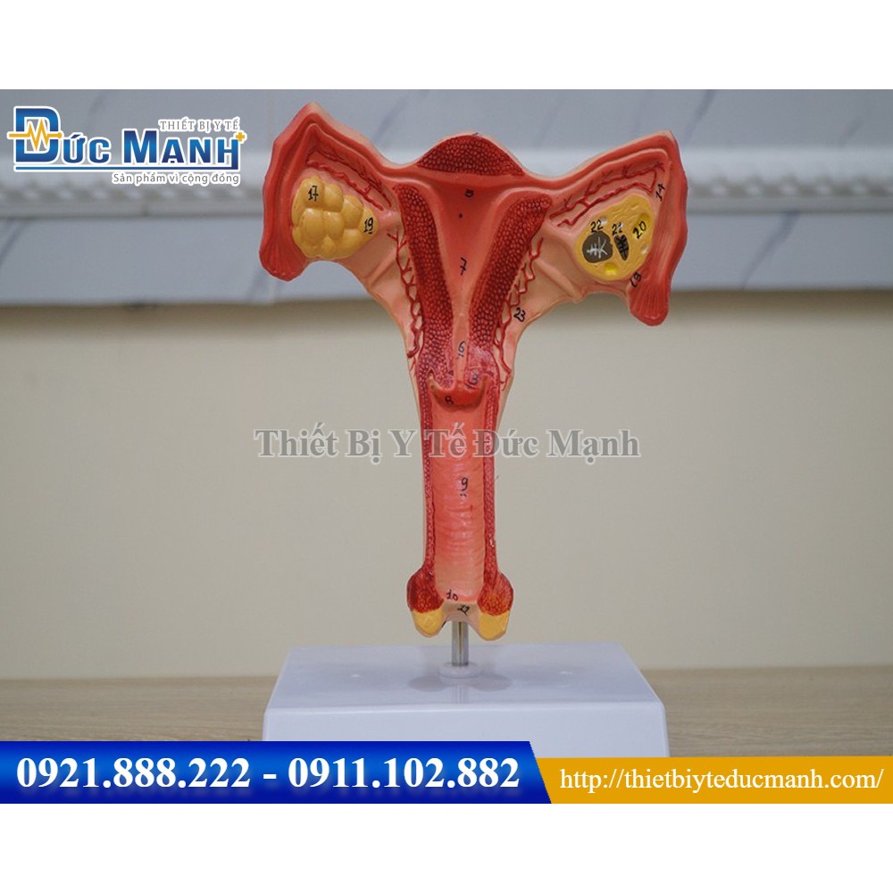 Mô hình giải phẫu tử cung