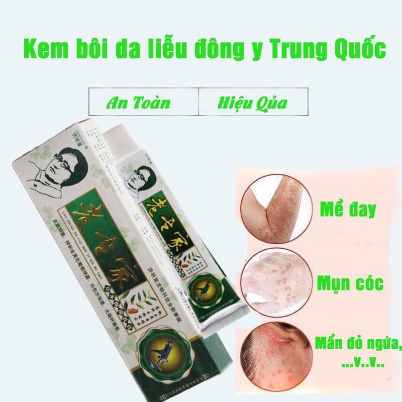 Hộp 20 tuýp kem bôi á sừng, nứt nẻ chân tay, côn trùng đốt hộp màu xanh