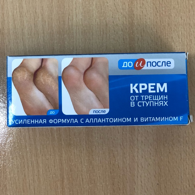 Kem trị nứt gót chân KPEM