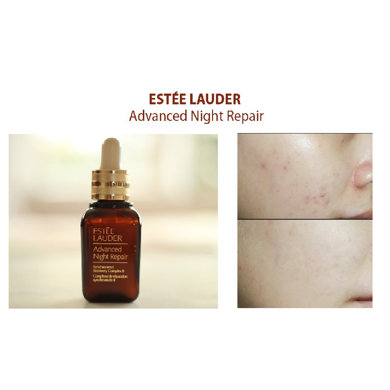 Tinh chất chống lão hoá Estee Lauder Serum ANR Night Advanced Repair - hàng bill Pháp