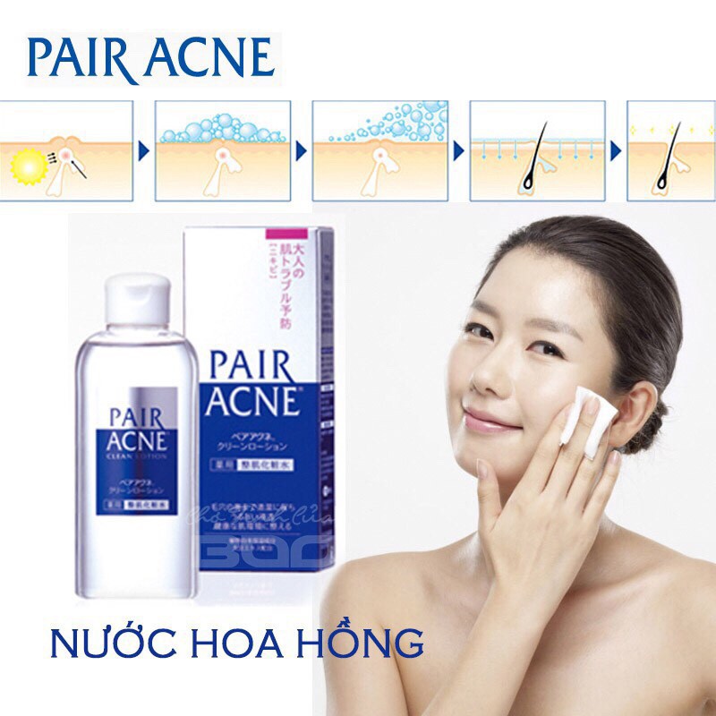 Nước Hoa Hồng PAIR Acne 160ml Ngăn Ngừa Giảm Mụn - Hàng Chuẩn Công Ty