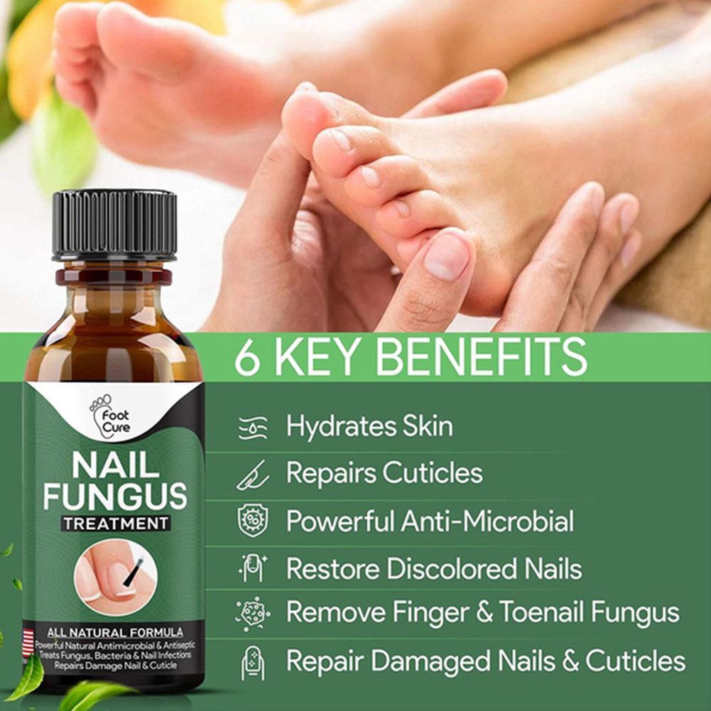 Dung Dịch Phục Hồi Móng Tay Và Chân Onychomyc T0B1 Chuyên Dụng Mới