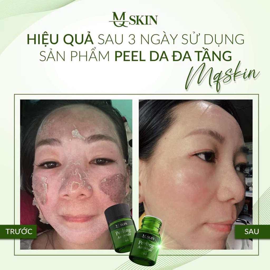 Peel Da Sinh Học Đa Tầng MQ Skin Chính Hãng Tái Tạo Da MQSKin