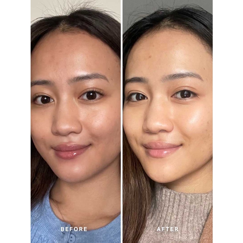 [TOP 1 SHOPEE] Pad tẩy da chết Alpha-H liquid gold with glycolic acid (Bill Anh)