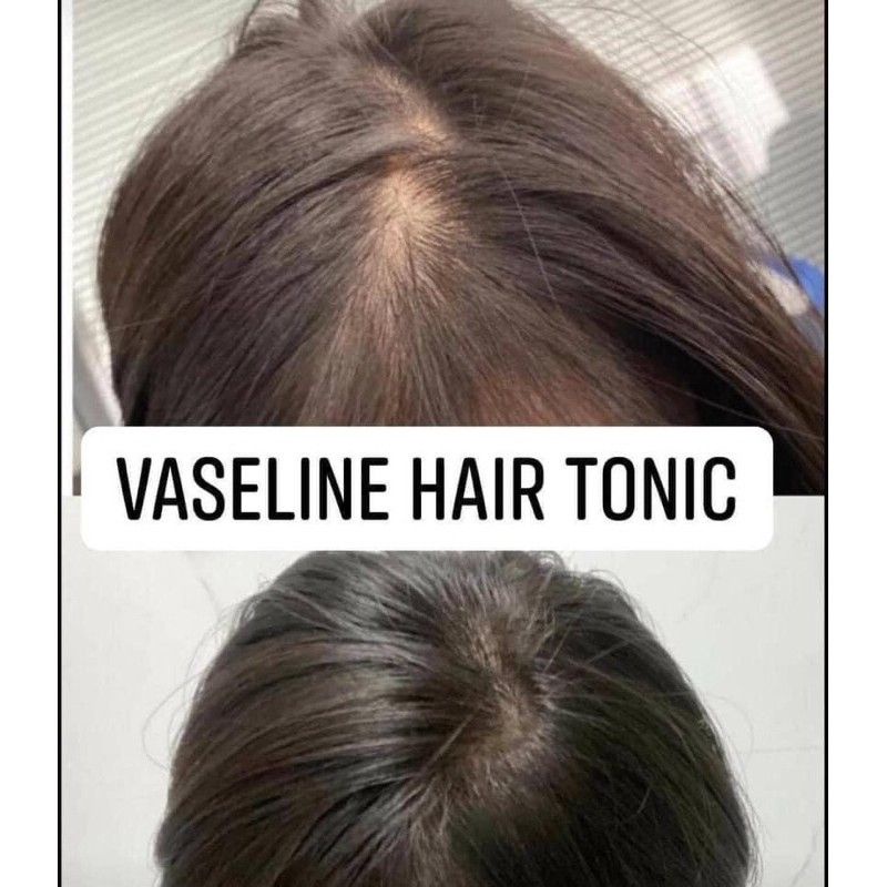 Dưỡng tóc Vaseline Hair Tonic 100ml