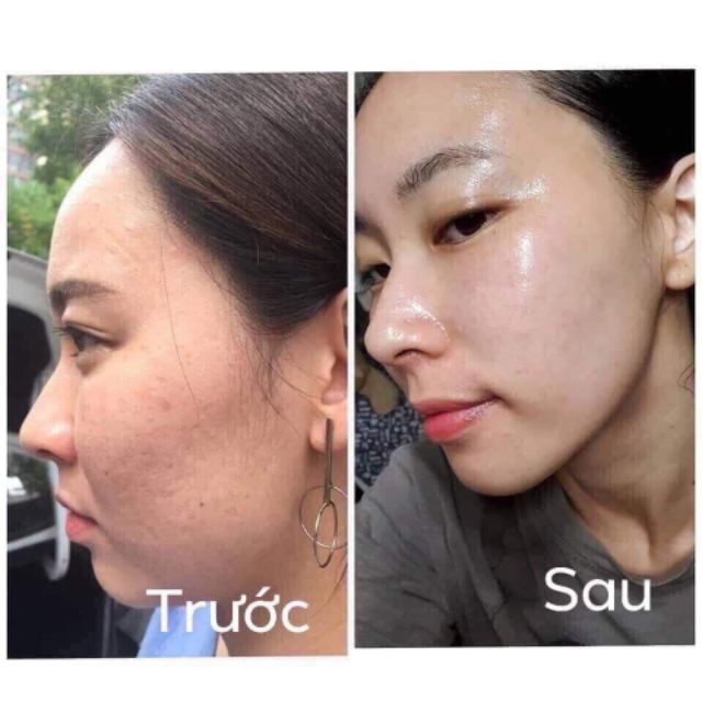 Kem Mờ Thâm Nách, Bẹn, Mông, Mụn, Đầu Gối, Quầng Mắt VERA - Công Dụng 7 Trong 1 - Tâm Sinh An Cosmetic