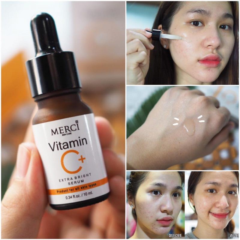 Serum Merci Vitamin C cho làn da trắng sáng mịn màng - Số 1 Thái Lan