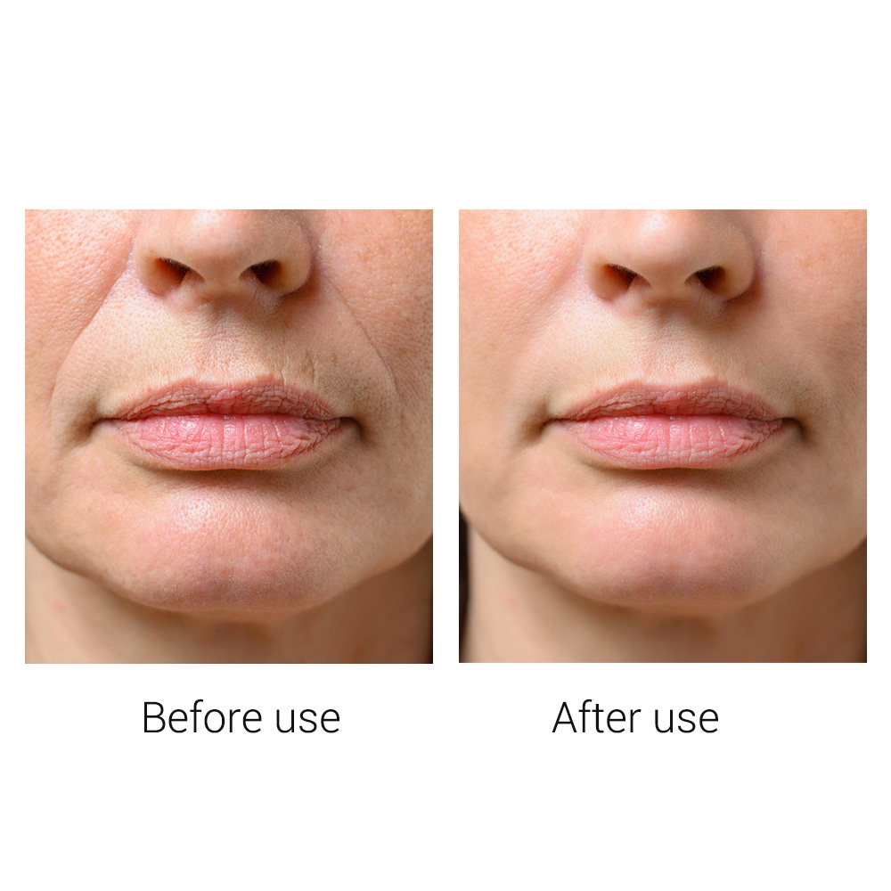 Mặt nạ serum hoa hồng BREYLEE nuôi dưỡng chăm sóc làm da tươi sáng hiệu quả
