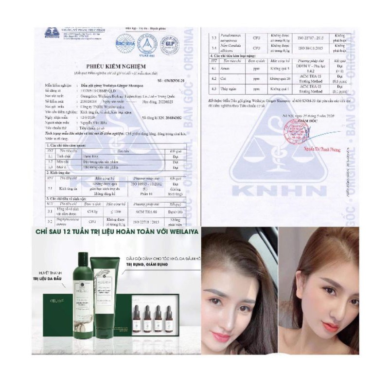 Dầu gội xả gừng thuốc bắc hà thủ ô weilaiya mọc tóc ngăn rụng tóc gừng Hà thủ ô mẹ sau sinh bầu mẹ cho tóc xơ da đầu khô | BigBuy360 - bigbuy360.vn