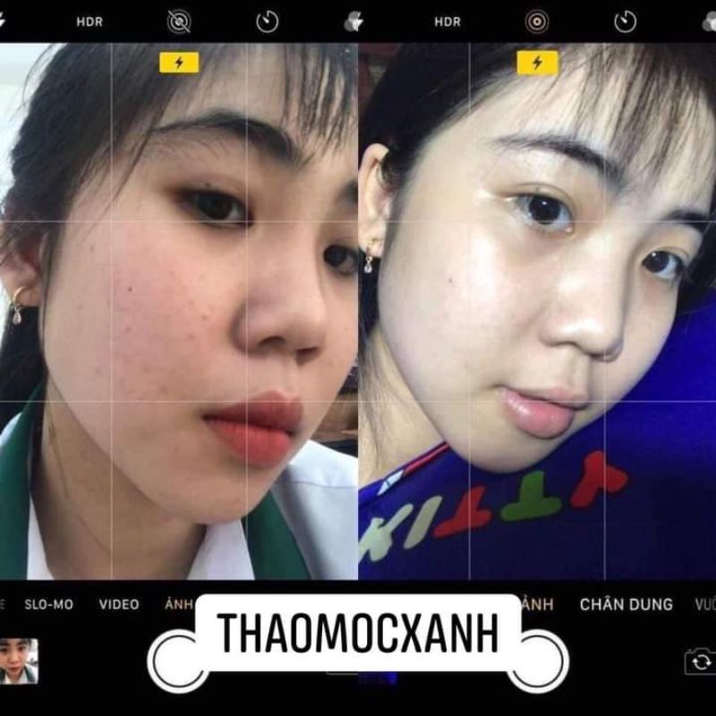 (Sẵn hàng) Combo trắng da- căng bóng trong 7 ngày 2 lọ | BigBuy360 - bigbuy360.vn