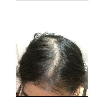 Bột phủ dày tóc hói tóc thưa Toppik + Tặng lược
