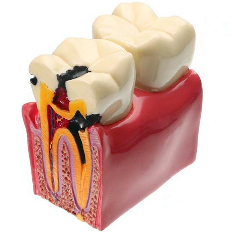 Mô Hình Hàm Răng Giải Phẫu 6 Lần Gấp 6 Lần Chất Lượng Cao