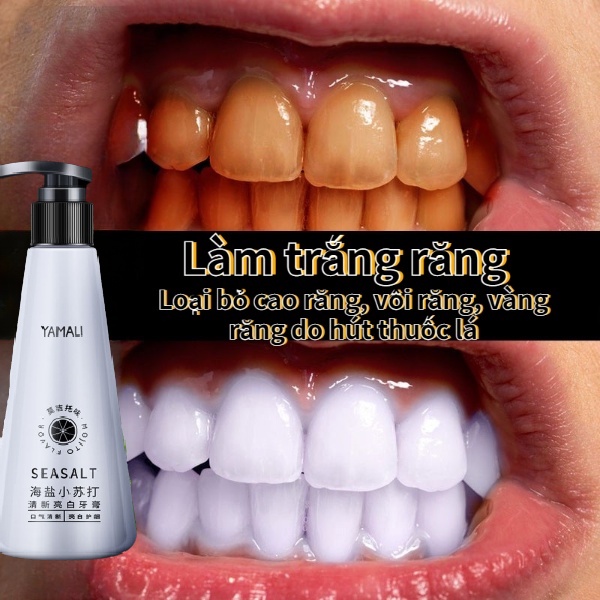 Kem đánh răng trắng răng kem đánh răng kem đánh răng muối 210g loại bỏ cao răng Giảm vi khuẩn miệng bảo vệ răng