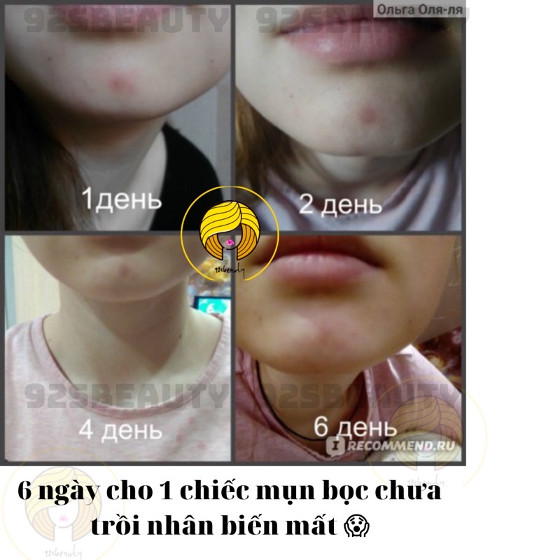 Gel BHA chấm mụn Compliment không chứa cồn giúp giảm mụn hiệu quả | BigBuy360 - bigbuy360.vn