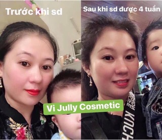 COMBO 3 CHAI TINH DẦU BƯỞI KÍCH MỌC TÓC ( tặng quà hấp dẫn )