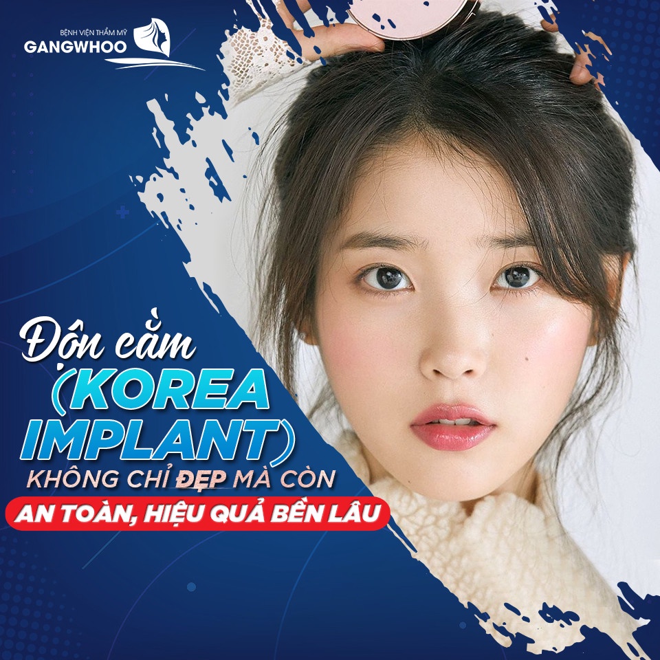 Độn Cằm Korea Implant tại Gangwhoo