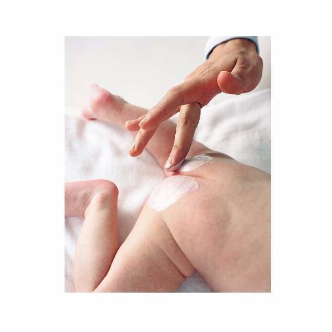 Kem Dưỡng A-DERMA Giúp Làm Dịu &amp; Hỗ Trợ Phục Hồi Da Dermalibour + Repairing Cream 50ml