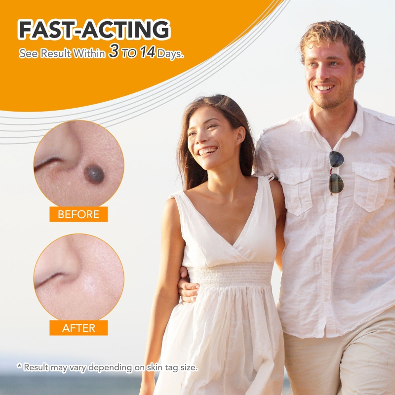 Dụng Cụ Tháo Nhãn Da Nhanh Chóng Không Đau 2-8 5Mm