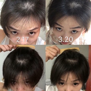 Cặp dầu gội biotin
