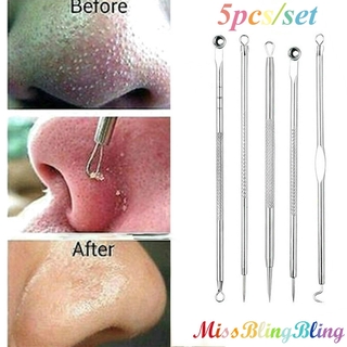 Dụng Cụ Nặn Mụn Đầu Đen, Mụn Trứng Cá