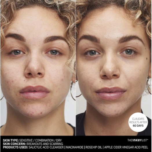 [TOP 1 SHOPEE] Dấm táo sáng da, mờ thâm The Inkey List Apple Cider Vinegar Acid Peel 30ml (Bill Anh)