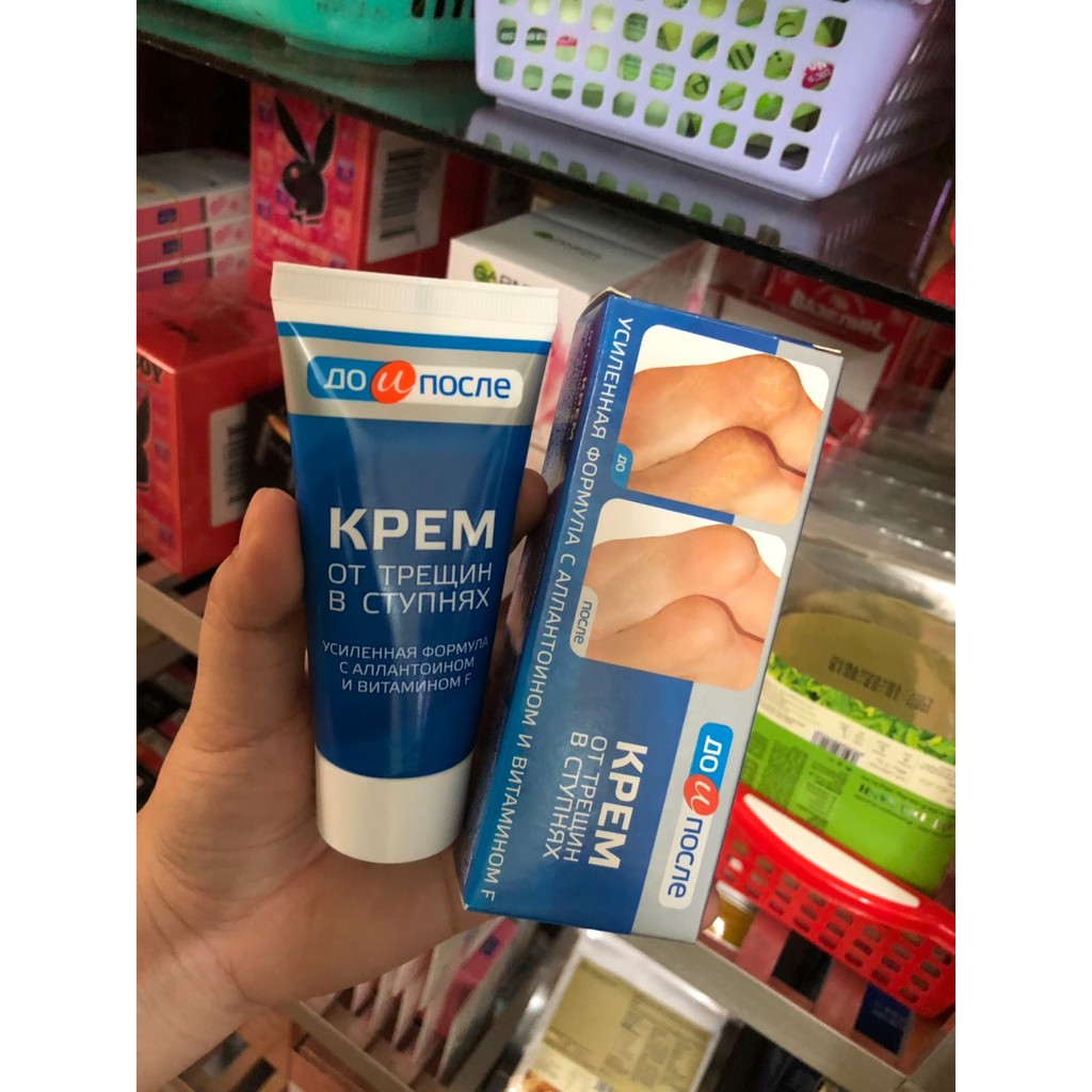 Kem trị nứt gót chân Kpem Apteka của Nga 50ml