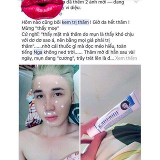 KEM TRỊ SẸO NGA KLIRVIN VỀ