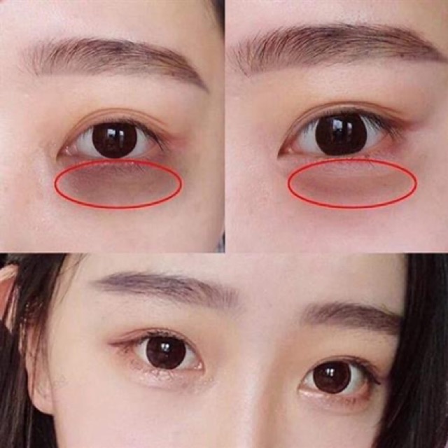 Kem mắt chống lão hoá Meishoku Whitening Eye Cream