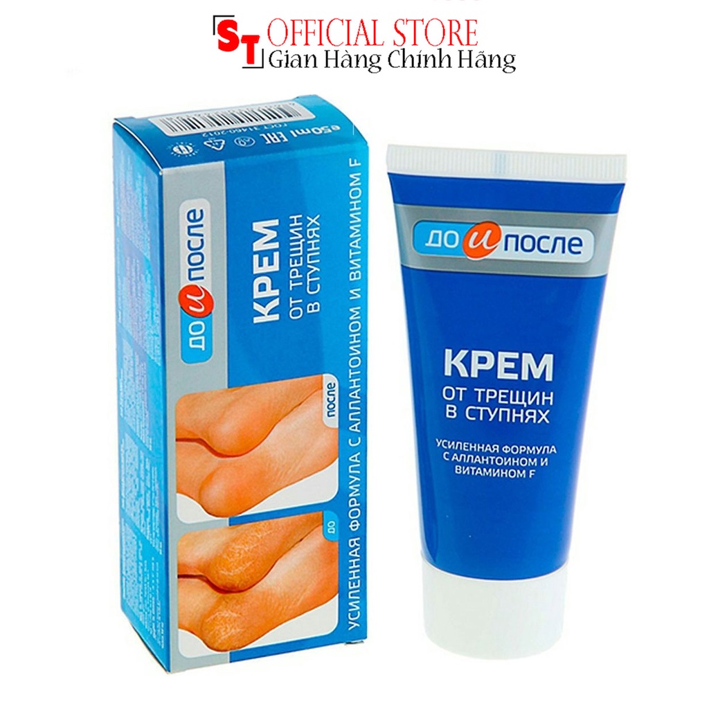 Kem Giảm nứt gót chân Kpem Apteka Chính Hãng 50ml Nga