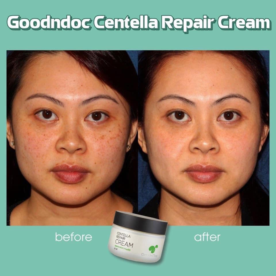 Kem Rau Má Dưỡng Ẩm Phục Hồi Giảm Thâm Nám Trắng Sáng Da Chống Lão Hóa GoodnDoc Centella Repair Cream