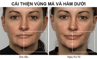 Cây lăn làm đẹp Refa Carat Face