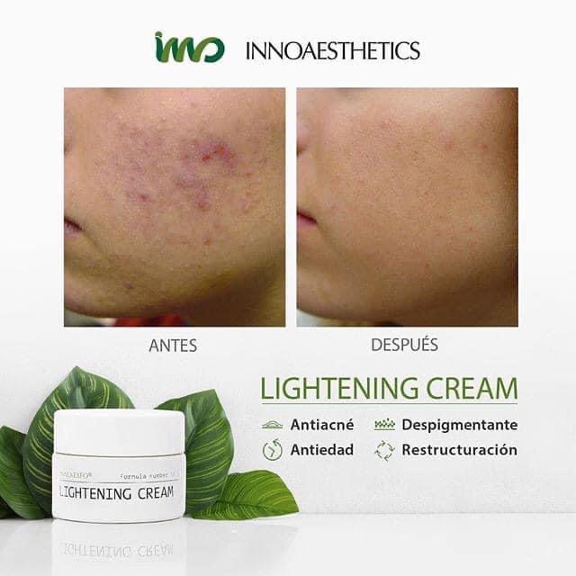 Tinh Chất Vitamin A 5% Innoaesthetics Inno Lightening Hoạt Chất Tái Tạo Đều Màu Da Giảm Thâm Mụn 15g
