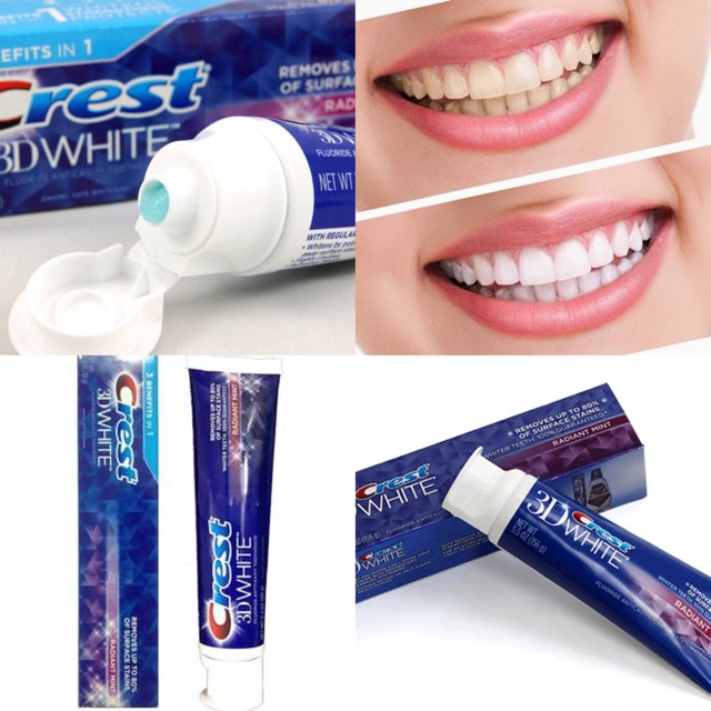 Kem đánh Răng Crest 3D White Radiant Mint bản Mỹ116gr - Làm trắng răng vượt trội cho hơi thở mát lạnh bạc hà