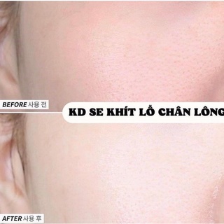 𝐊𝐄𝐌 𝐃𝐔̛𝐎̛̃𝐍𝐆 BIO DERMA 𝐗𝐀𝐍𝐇 𝐋𝐀́- 𝐒𝐄 𝐊𝐇𝐈́𝐓 𝐋𝐎̂̃ 𝐂𝐇𝐀̂𝐍 𝐋𝐎̂𝐍𝐆, 𝐊𝐈𝐄̂̀𝐌 𝐃𝐀̂̀𝐔
