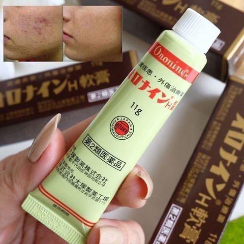 Kem Bôi Lành Vết Thương Oronine 11g