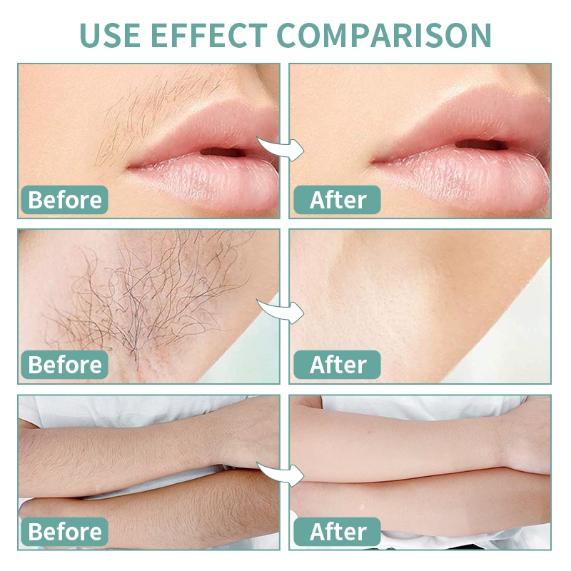 Giấy tẩy lông RUOALL vùng bikini/vùng da dưới cánh tay/chân/mặt an toàn tiện dụng 150g