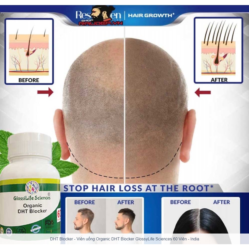 DHT Blocker Organic - Giảm Nhờn Da Đầu - Mọc Tóc Ngăn Rụng Tóc